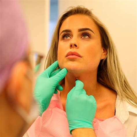 Belkyra behandeling – Doctor Face.